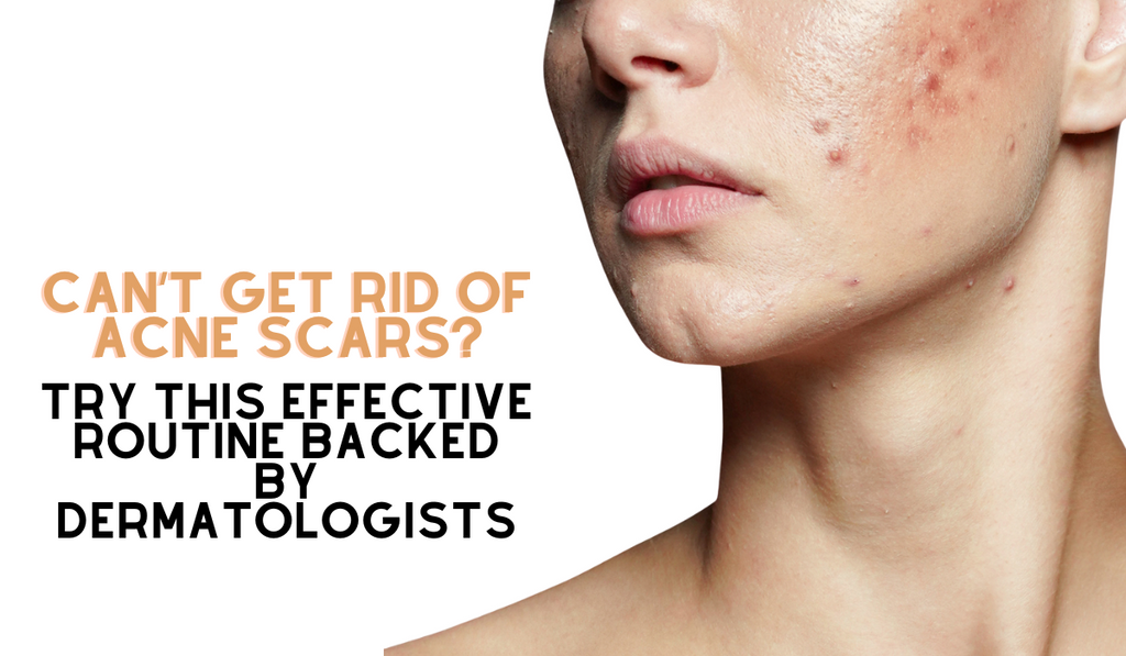 Can’t Get Rid of Acne Scars? Try This Effective Routine Backed by Dermatologists