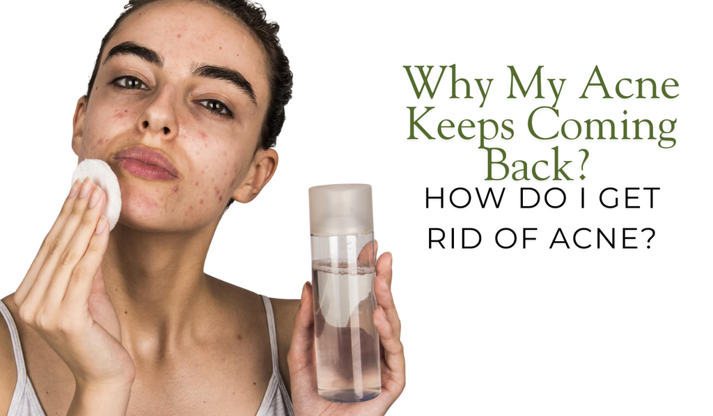 Why My Acne Keeps Coming Back? How Do I Get Rid Of Acne?