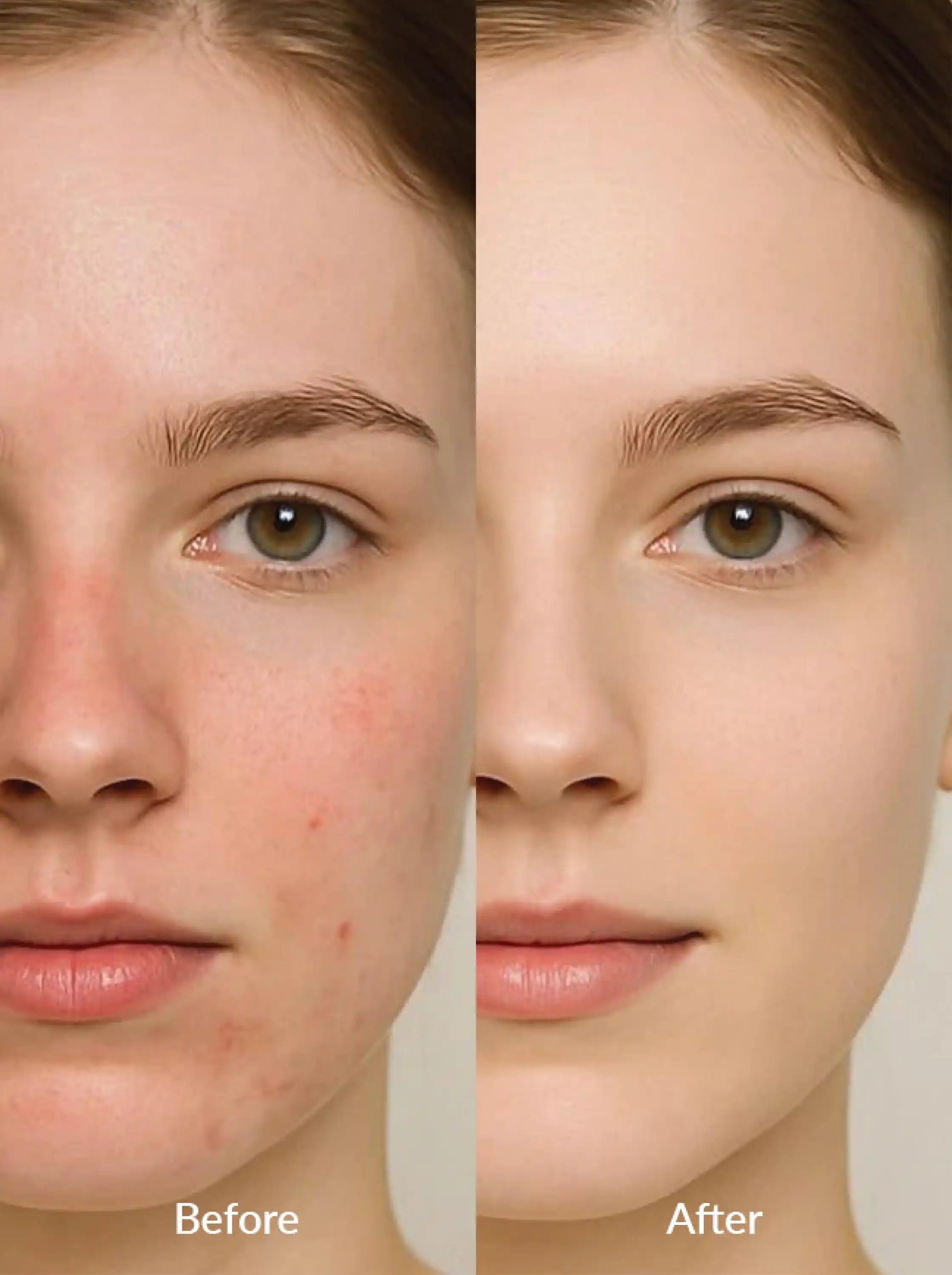 Advanced Barrier Repair Moisturizer (Ceramides 1% + Niacinamide 6% + Hyaluronic Acid 1% + Vitamin B5 1%)