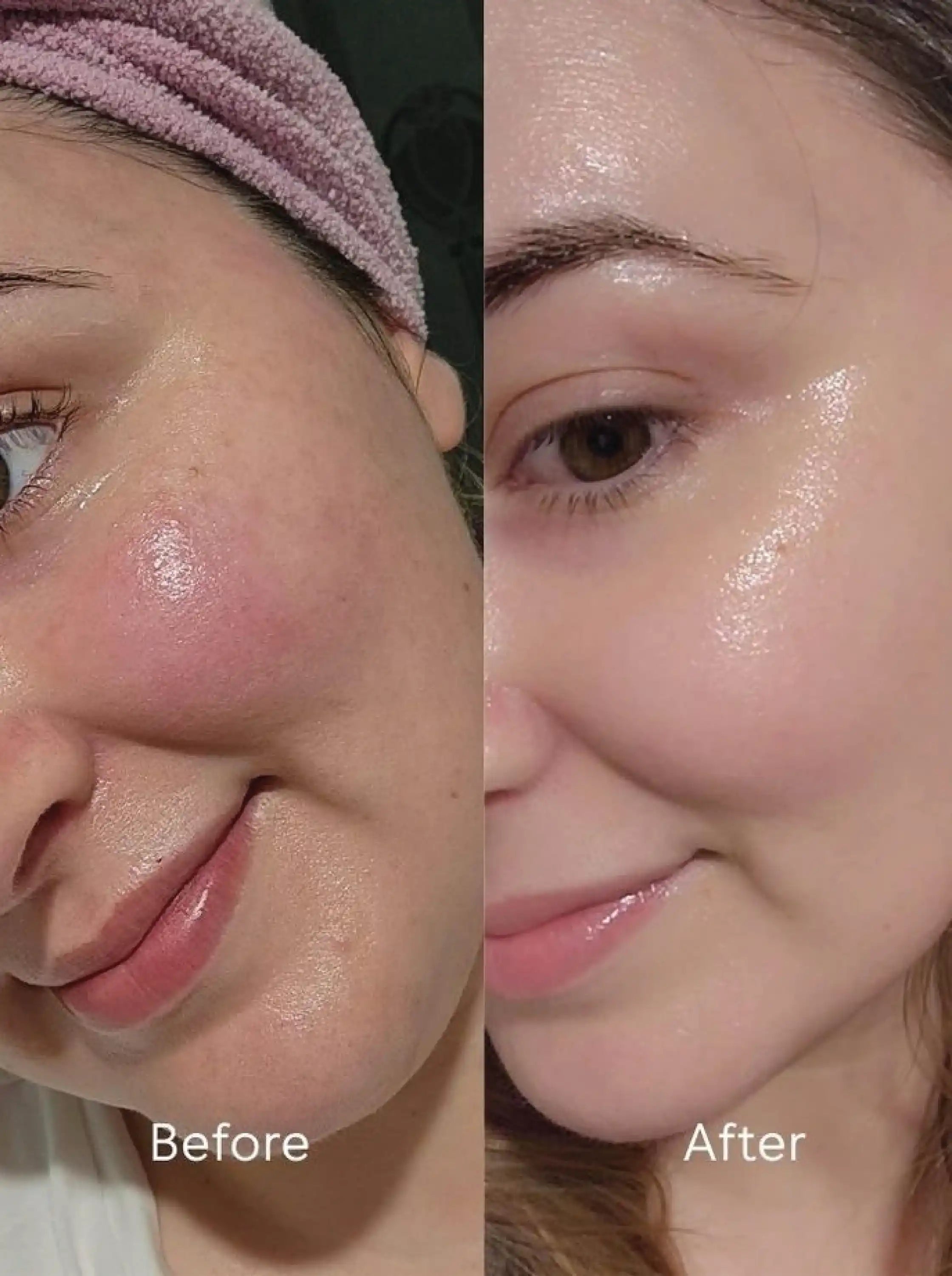 Daily Brightening Moisturizer (Kojic Acid 3% + Alpha Arbutin 2% + Niacinamide 6% + Hyaluronic Acid 1%)