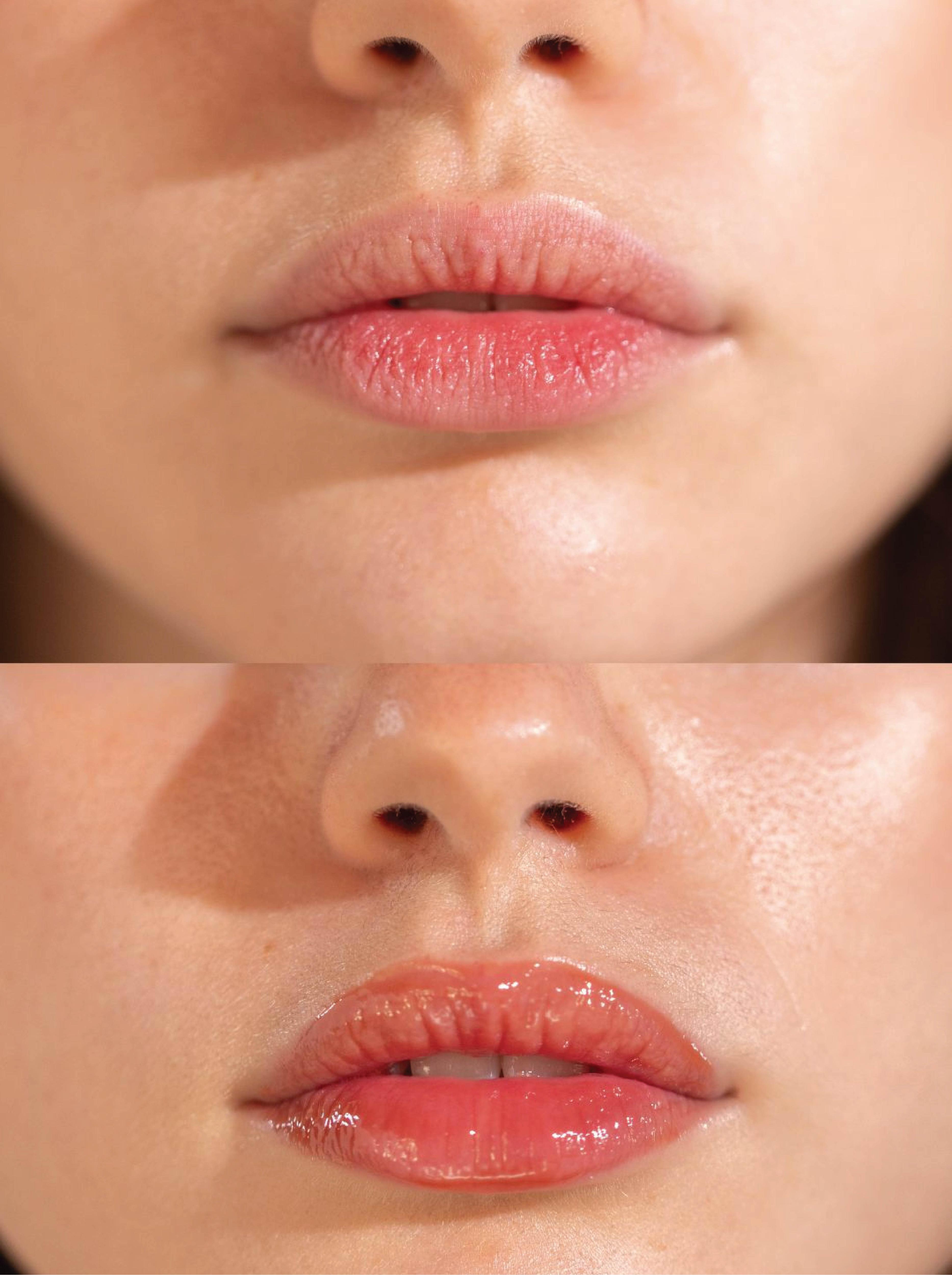 Beautenic Lip Balm with Coffee + Peptide Complex