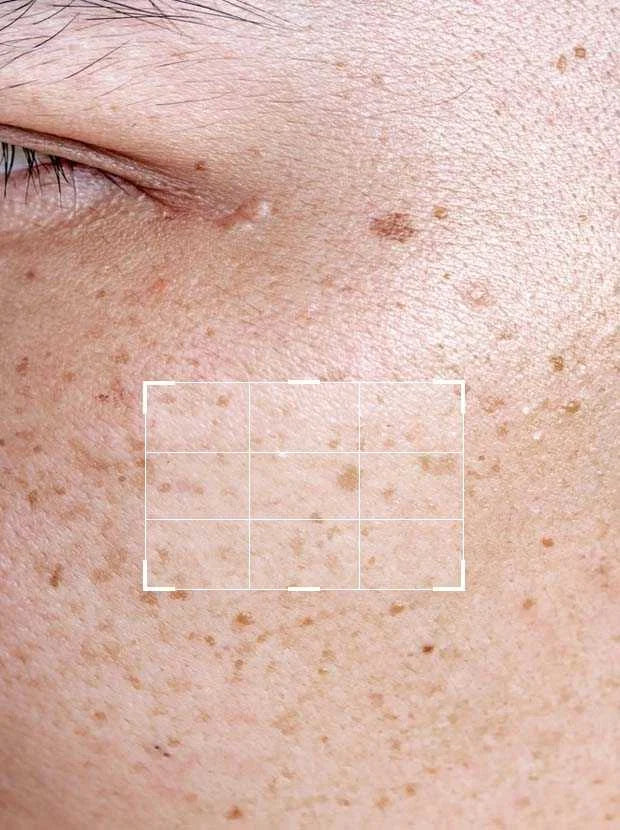 Glycolic Acid 7% Serum