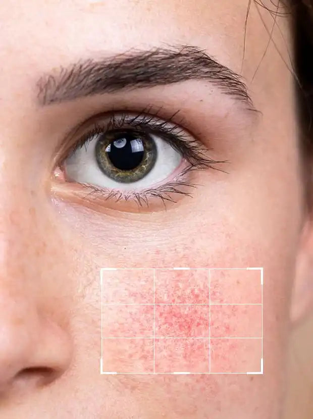 Mendalic Acid 10% + HA 2% Serum