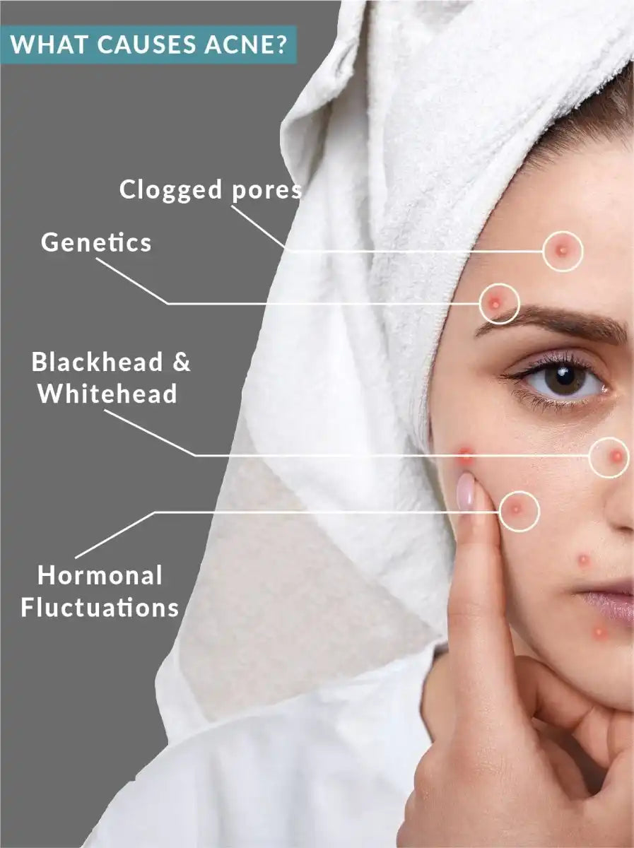 Salicylic Acid 2% Clarifying Toner